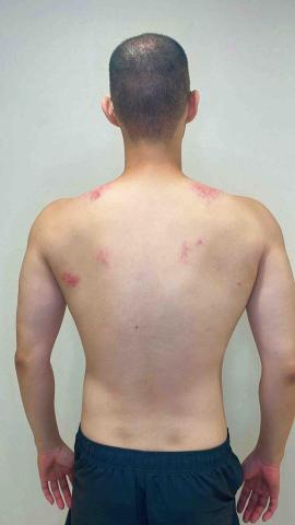 馧體態 - 護理師 