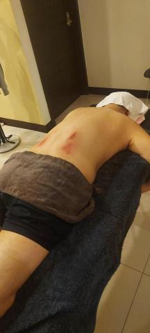 林師傅專業到府按摩整復服務 - 長期腰痛，排除。