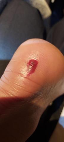 林師傅專業到府按摩整復服務 - 足底足根 筋膜炎排除。