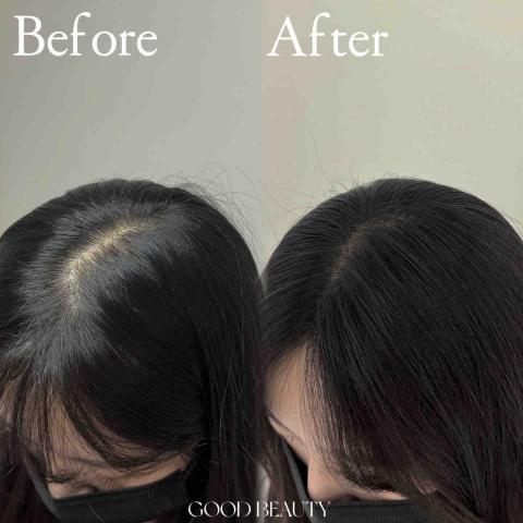 施施 - SMP紋髮頭頂分線