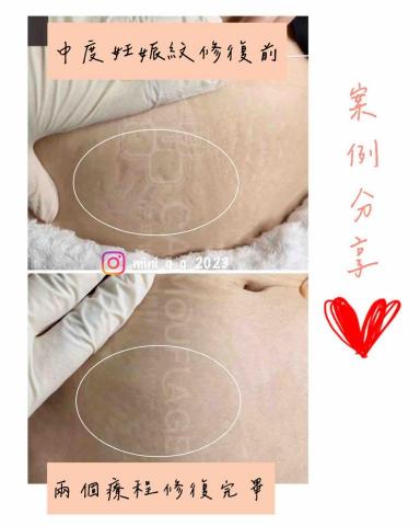 Yun-Ching Sun - 紋路修復對比