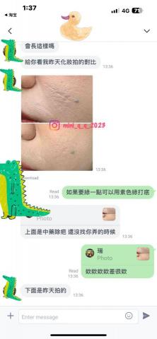 Yun-Ching Sun - 法式永膚修復後滿意回饋