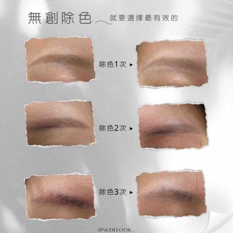 裸妝美學｜霧眉·除色·睫毛管理·肌膚管理 - 無創淡色-無修復期零傷口