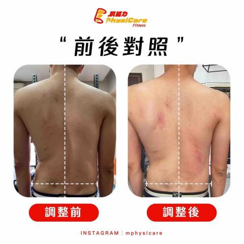 國考體測-Mike教練 - 脊椎側彎訓練