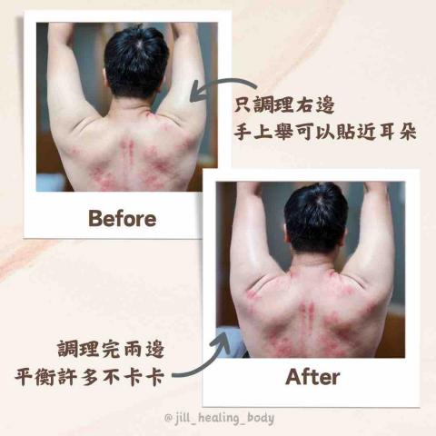 Na Na Lu Fa | 療癒站 - 水牛角刮筋調理前後對比