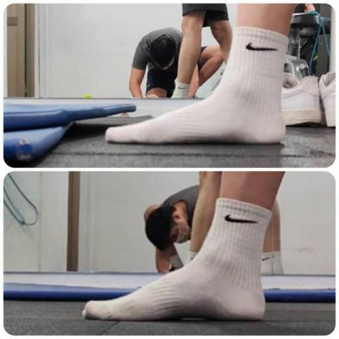 吳明儒 - 足弓塌陷處理