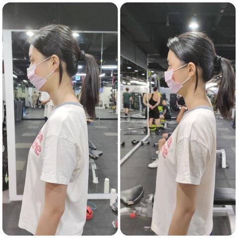 吳明儒 - 烏龜頸調整