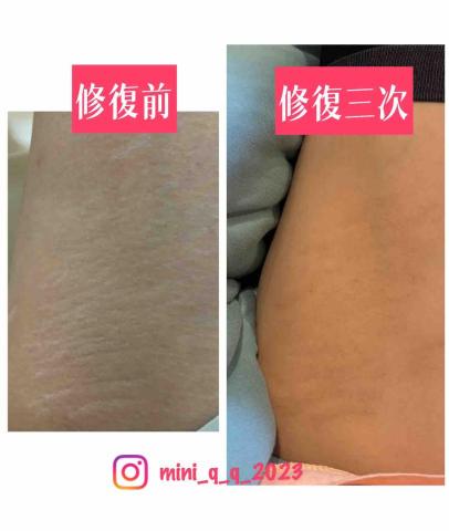 Yun-Ching Sun - 修復對比圖