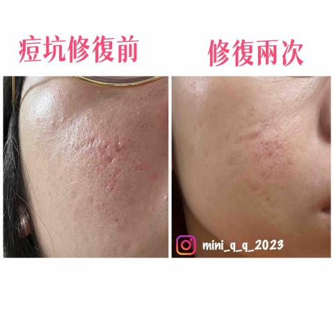 Yun-Ching Sun - 修復對比圖