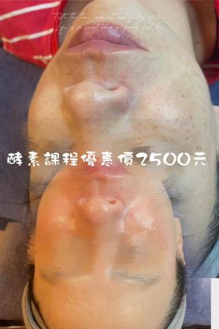 劉雨榛 - 酵素課程