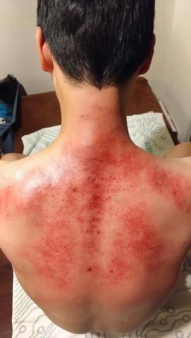 按爽-日式無痛理療按摩/科技采耳_ 耳燭( 店面/御用到府) - 電動滑罐+刮痧 按爽-日式無痛理療按摩/科技采耳_ 耳燭( 店面/御用到府) - 電動滑罐+刮痧