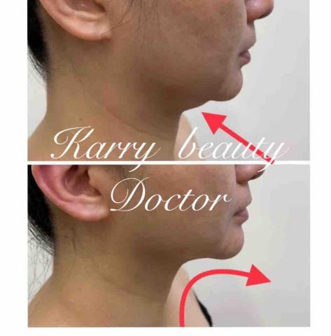 Ｋ_healthy質感調理 - 客人本身皮膚易泛紅
做完退紅直接改善很多
雙頰跟下巴更加緊緻拉提
撫平細紋 雀斑變淡

效果這麼好 歡迎來體驗～～