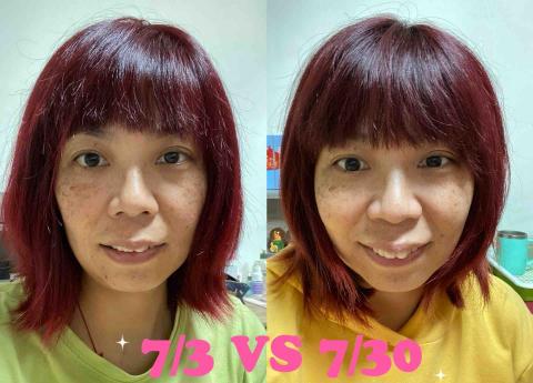 Candy Chen - 淡化斑改善水腫