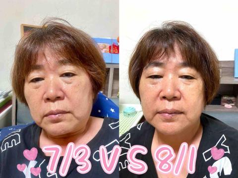 Candy Chen - 血壓、血糖下降。 改善抽筋症狀，淡化眼袋跟法令紋