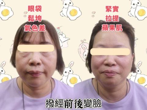 林珊妮 - 撥經變年輕