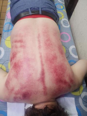 林珊妮 - 電腦族肩頸僵硬