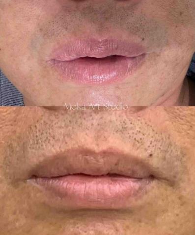 MoKa Art Studio 眉|眼|唇 半永久 - 男士也有暗沉唇的困擾喔! MoKa Art Studio 眉|眼|唇 半永久 - 男士也有暗沉唇的困擾喔!
