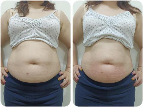 懿紜 - 使用雲朵機塑腹20分效果