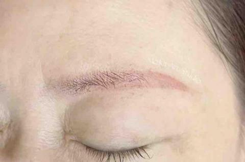 MoKa Art Studio 眉|眼|唇 半永久 - 舊式紋繡後期易發生的紅眉(改眉前) MoKa Art Studio 眉|眼|唇 半永久 - 舊式紋繡後期易發生的紅眉(改眉前)