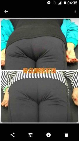 有酸痛請找卓老師 - 骨盆調整