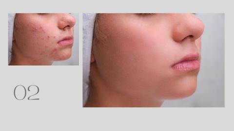 Kiwi's Work Shop - 影像修圖-人像 (膚質改善)