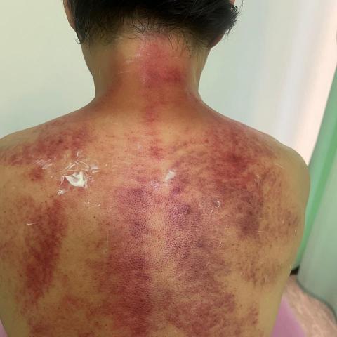 提供jk指壓服務的專家凱