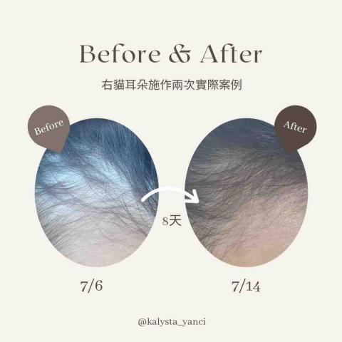 Yanci - 右貓耳朵施作兩次實際效果