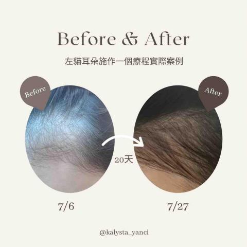 Yanci - 左貓耳朵施作一個療程實際案例