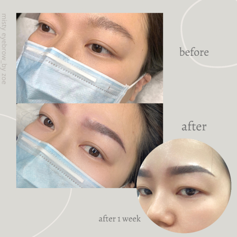 Zoe - Before/After/Feedback