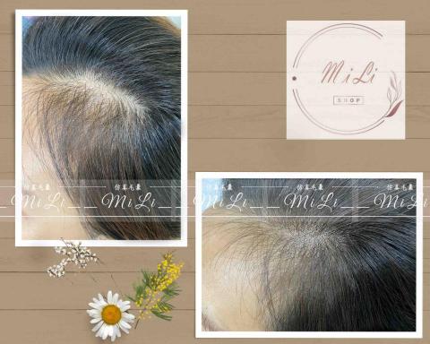 米莉美學-美甲.美睫.半永久眉眼唇.紋髮 - 客人非常在意髮縫很稀疏,紋髮點刺手法做出毛囊感,看起來效果非常自然。 米莉美學-美甲.美睫.半永久眉眼唇.紋髮 - 客人非常在意髮縫很稀疏,紋髮點刺手法做出毛囊感,看起來效果非常自然。