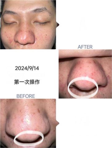 Julie的肌膚管理課程 - 