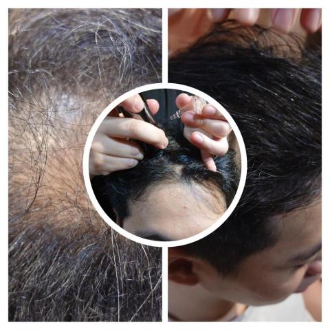 蔡欣宜 - 外泌體育髮