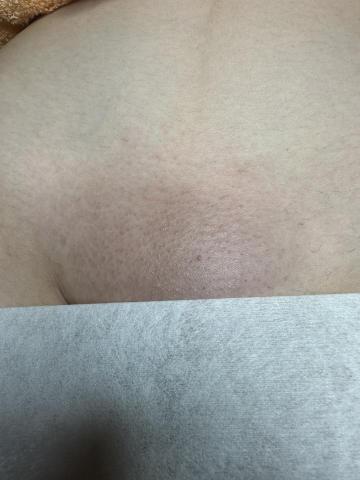 LC熱蠟美學 - 私密處全除