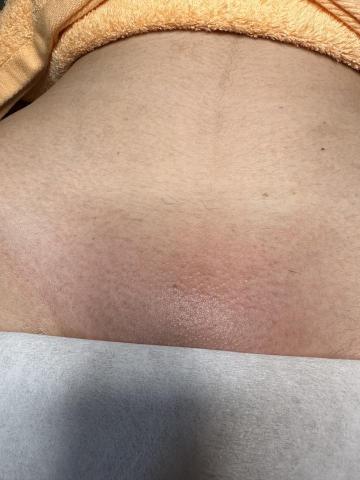 LC熱蠟美學 - 私密處全除