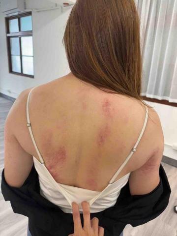 沐絺療癒空間 - 艾草溫罐活絡