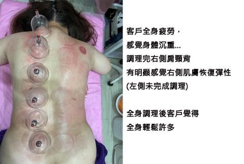 吉祥健康傳統整復推拿 - 113/07/08客戶分享照片