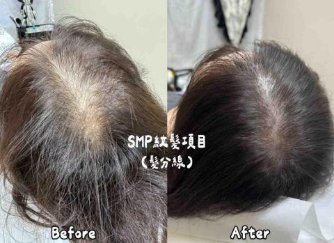 Chao Studio - 髮分線