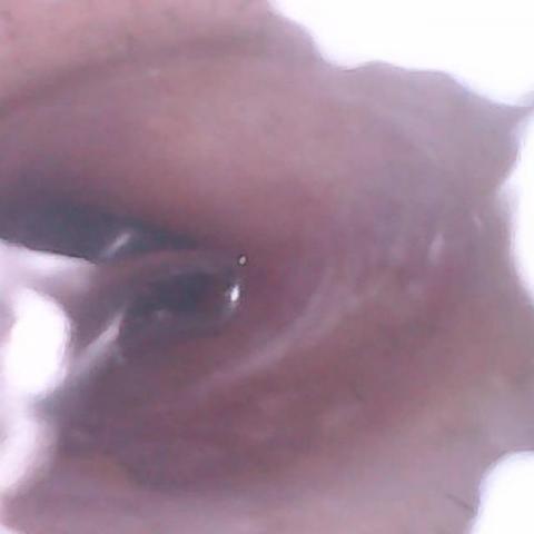 按爽-日式無痛理療按摩/科技采耳_ 耳燭( 店面/御用到府) - 可視化內顯視采耳 按爽-日式無痛理療按摩/科技采耳_ 耳燭( 店面/御用到府) - 可視化內顯視采耳