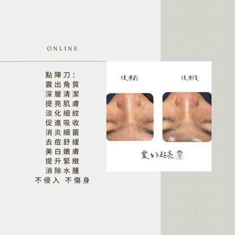 平靜美學空間 - DA點震刀純物理清潔，依靠高頻震動震出老角廢質和多余皮脂，不需要在臉上抹東西，不用擔心過敏問題。

P-2等離子將空氣中的氮氣轉化為高能量微等離子體，同時將空氣中的氧氣轉化為臭氧，與皮膚0接觸即可快速殺滅活細菌，淨化皮膚，提高皮膚吸收營養的能力。

E-3聚能指套將EMS微電流聚集於施力指尖，搭配聚能指套手法，通過發送溫和電波，透過膚皮組織，消除水腫，喚醒皮膚活力。