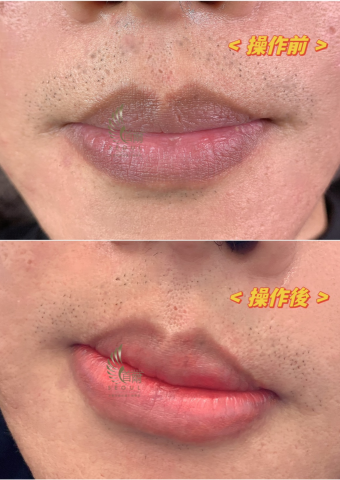首爾美睫紋繡 - 男生操作唇 當下效果