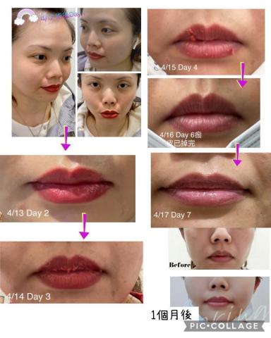 chenyu韓式半永久紋繡保養 - 輕微烏唇當下做完和恢復過程