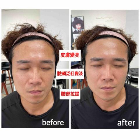 Minnie.工作室 - 臉部撥筋