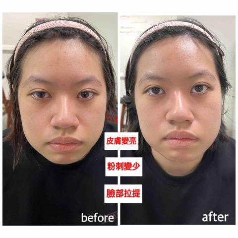 Minnie.工作室 - 臉部撥筋