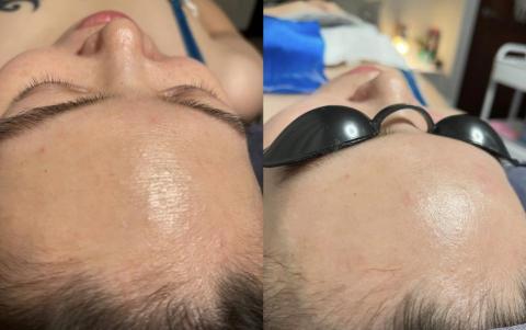 懶女孩 lazy girl_studio - 高階護膚管理