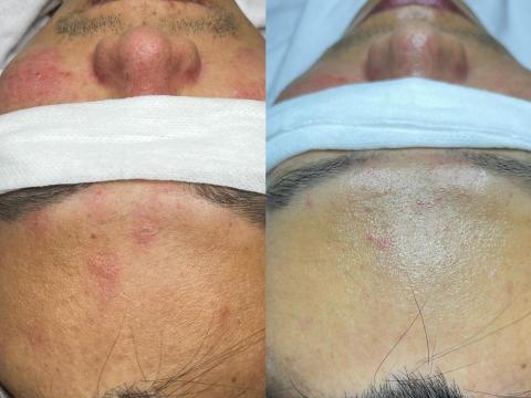 懶女孩 lazy girl_studio - 皮膚細緻度細紋改善