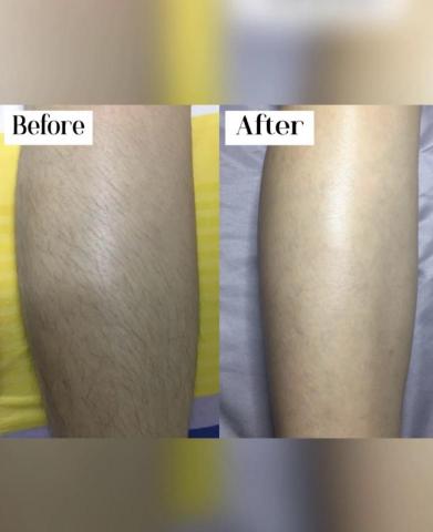 懶女孩 lazy girl_studio - 除毛服務