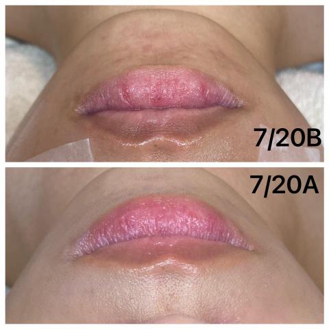 Ya靠臉吃飯 - 加購唇部保養有效改善脫皮、龜裂問題❤️