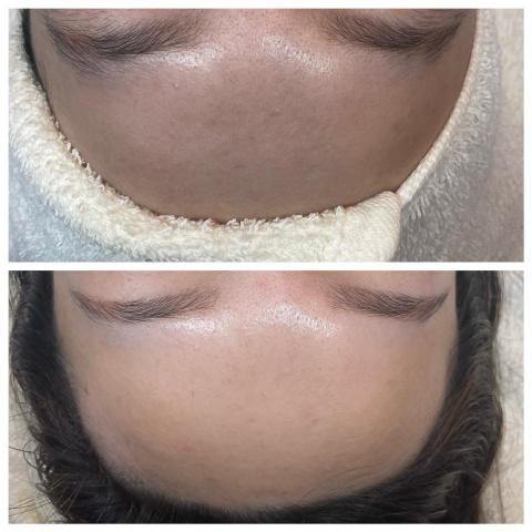 Ya靠臉吃飯 - 一次課程，即使本身膚白也還能更乾淨提亮，改善顆粒感❤️