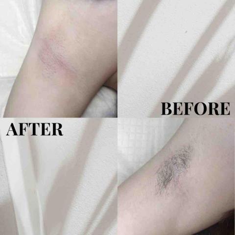 Jxone_熱蠟除毛 - 