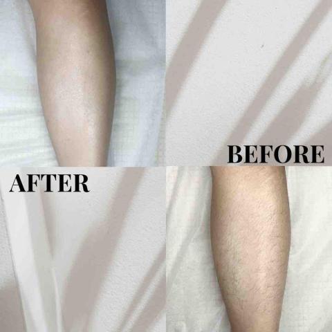 Jxone_熱蠟除毛 - 